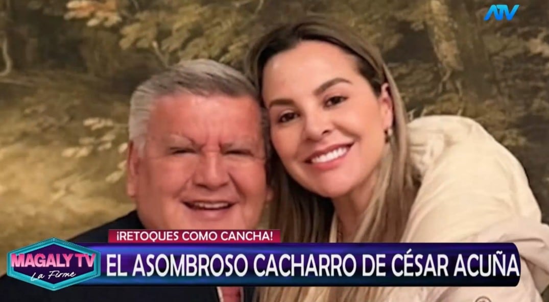 ¿Qué se habría hecho César Acuña en el rostro? Magaly Medina reacciona y especialistas analizan su apariencia. Captura: Magaly TV La Firme.
