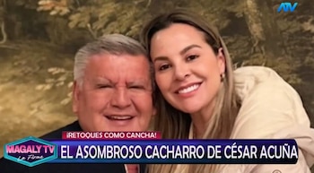 ¿Qué se habría hecho César Acuña en el rostro? Magaly Medina reacciona y especialistas analizan su apariencia. Captura: Magaly TV La Firme.