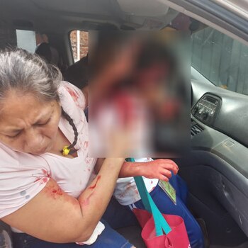 Miguel resultó severamente herido. (Foto: