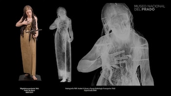 Técnica de rayos X en