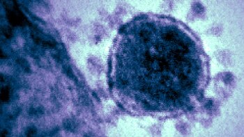 Descartados cuatro de siete casos