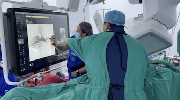 Especialistas combinaron técnicas endovasculares para cerrar la cavidad dañada. (CSS)