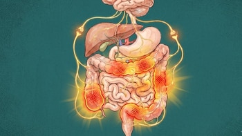 Intestino irritable: terapias eficaces, errores comunes y el impacto de la desinformación en el manejo del trastorno crónico