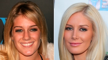 Heidi Montag se sometió a