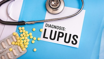 Las sesiones de terapia virtual mejoran la vida de niños con lupus