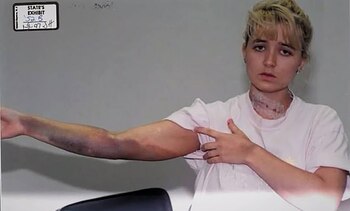 La mujer muestra las heridas