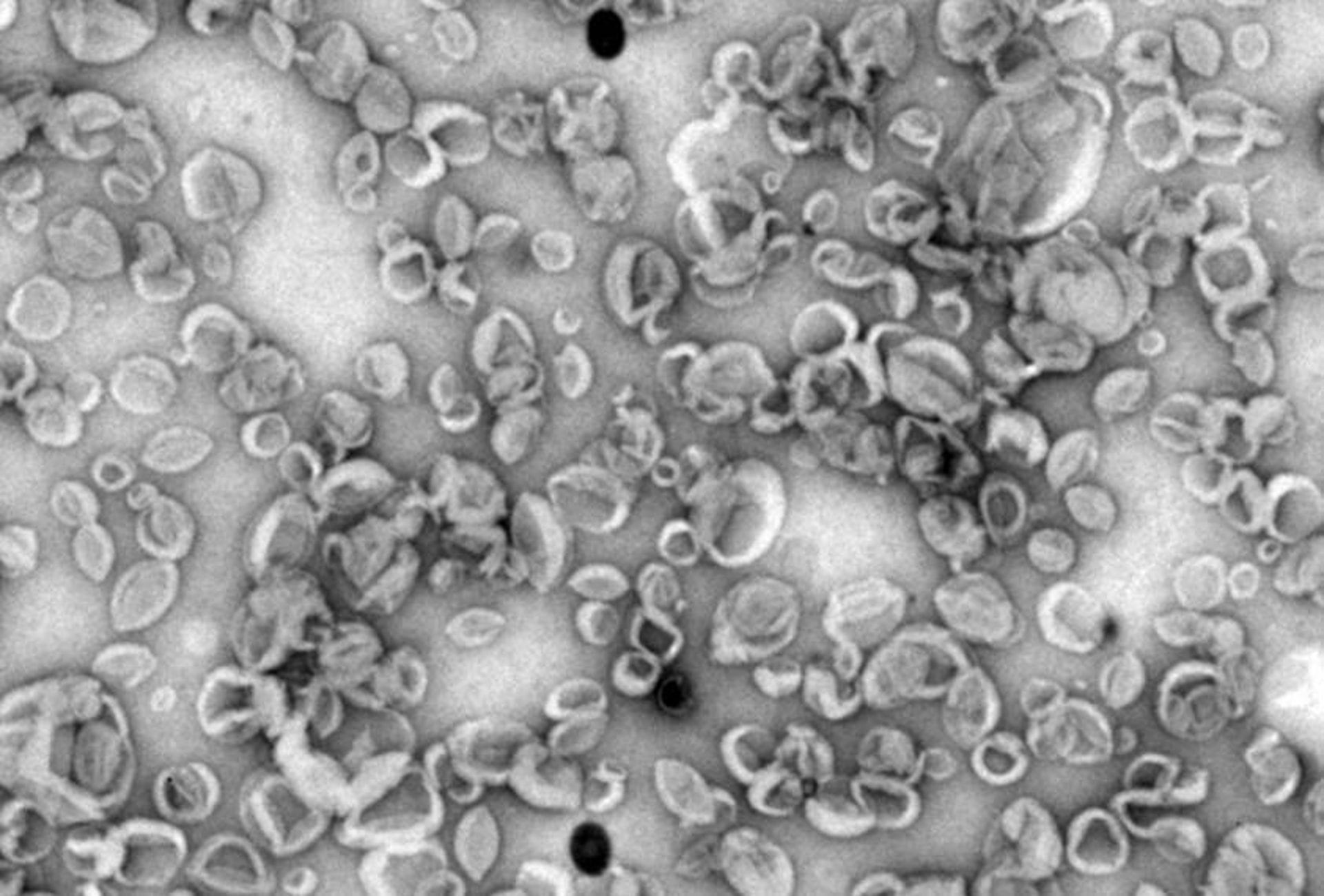 CBM crea nanovehículos sintéticos que potencian respuesta inmunitaria como posibles precursores de vacunas más eficaces