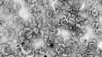 CBM crea nanovehículos sintéticos que potencian respuesta inmunitaria como posibles precursores de vacunas más eficaces