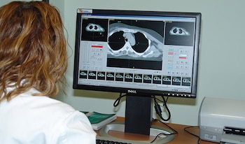 El cáncer es una enfermedad