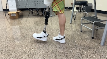 Amputaciones en Costa Rica aumentaron