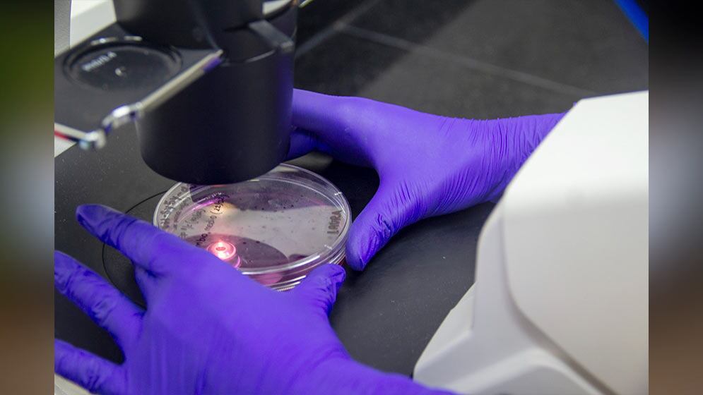 Los resultados del estudio provienen de modelos experimentales y aún necesitan confirmación en personas y en otras enfermedades./ Conicet