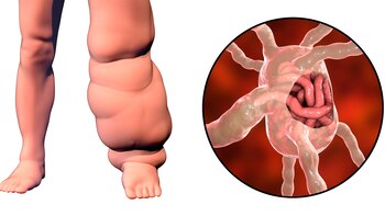 Los adultos se localizan en