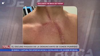Joven agredido por Aline (Mediaset)