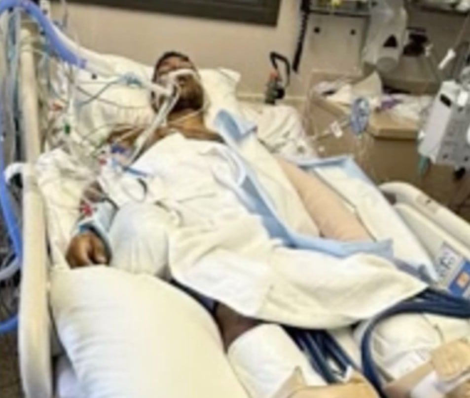 Alex Valencia perdió varias extremidades tras contraer una grave infección en un centro de detención en Alaska gestionado por ICE - crédito Univisión