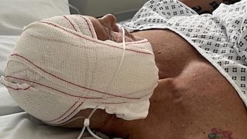 Las sobrecogedoras imágenes de Kiko Matamoros tras una nueva operación estética a sus 69 años: “Tengo más puntos que votos va a sacar Riquelme el domingo”