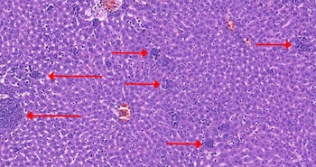 Tejido hepático de un ratón