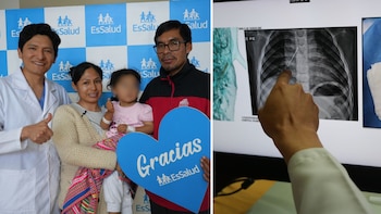 Milagro médico en Lima: Niña