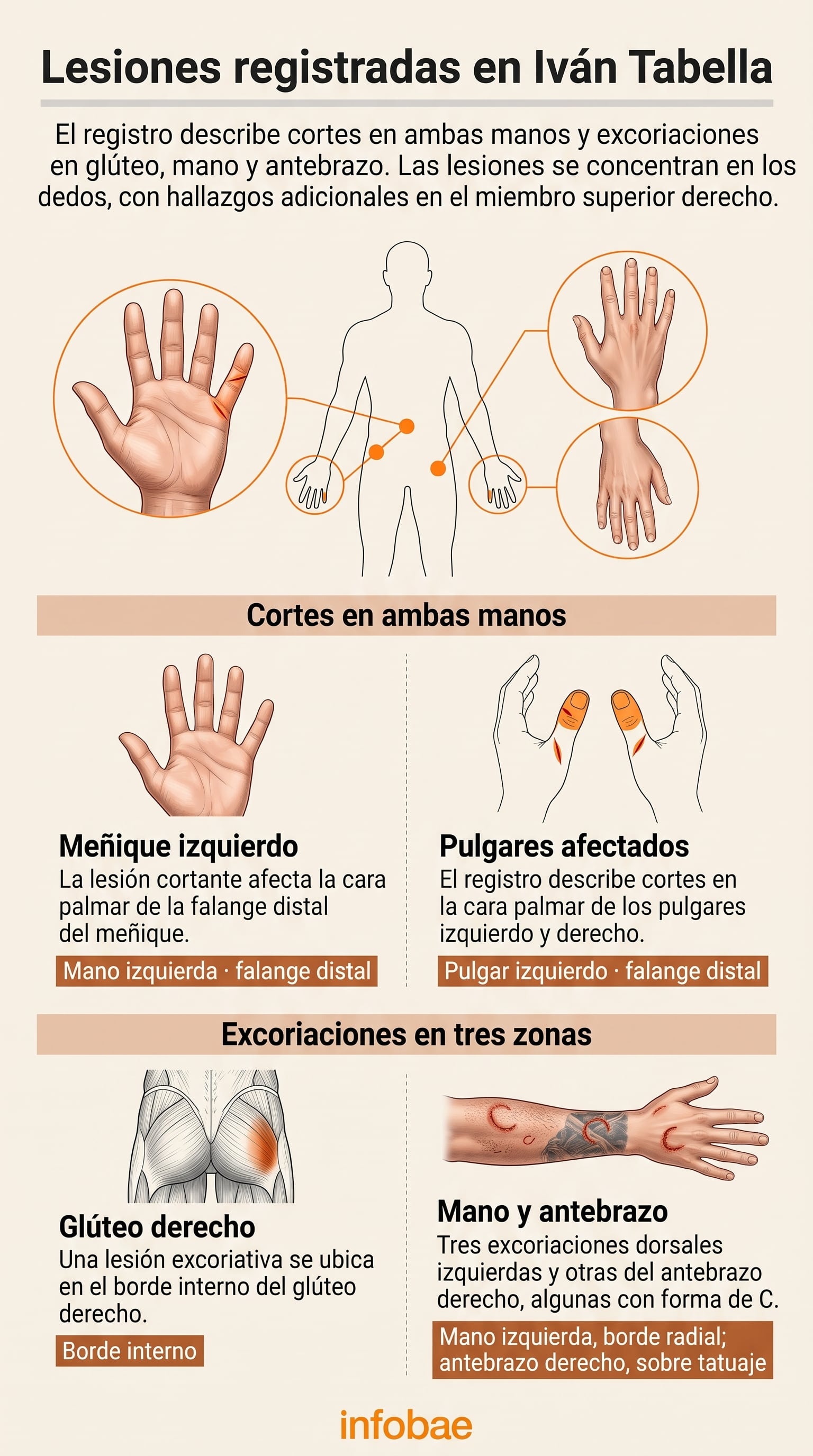 Una infografía de Infobae detalla las heridas cortantes en las manos y las excoriaciones registradas en el cuerpo de Iván Tabella. (Imagen Ilustrativa Infobae)
