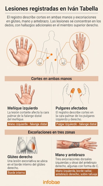 Infografía con diagramas del cuerpo humano, manos, antebrazo y glúteo que señalan diversas heridas, acompañada de textos explicativos.