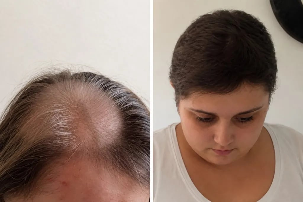 La paciente dijo que cuestionó estudios que no mostraban evidencia de cáncer, pero continuó el fármaco más allá de los seis meses recomendados (Captura de video)