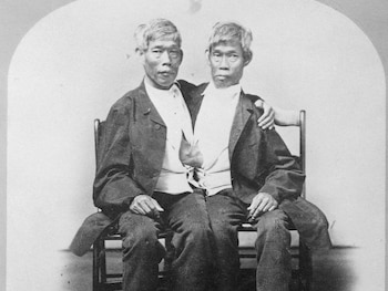 Los hermanos siameses Chang y