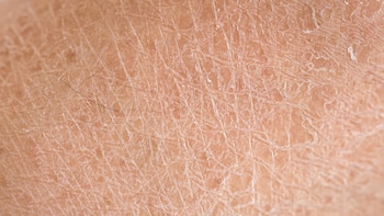 Detalle de una piel que