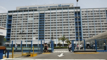 Denuncian que paciente con fractura mandibular sigue sin cirugía tras ingreso al hospital Rebagliati