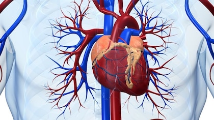 Cateterismo cardiaco: un estudio afirmó que no es necesario ayunar antes de la operación