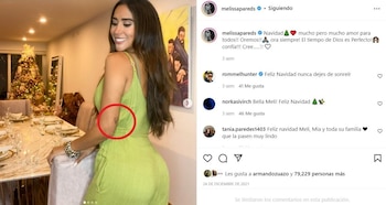 Melissa mostró su tatuaje en