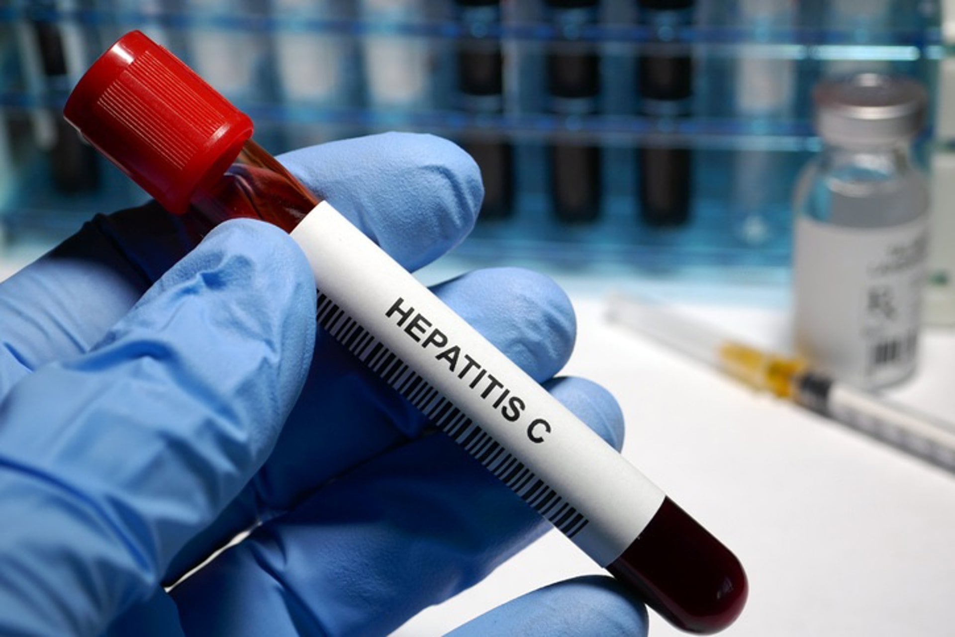 Su médico le dijo que la hepatitis C era una sentencia de muerte y que le quedaban unos 10 años de vida (Europa Press)