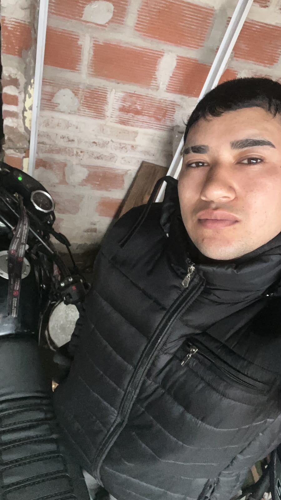 Alexis estaba desocupado al momento del accidente y ahora le espera una larga recuperación