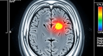 El avance científico demuestra que