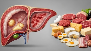Cuál es el tipo de queso que más calcio aporta pero menos daña tu hígado
