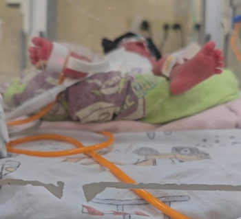 La cifra de menores fallecidos por tosferina en el país asciende a 13, según reportes recientes de las autoridades sanitarias de Honduras.