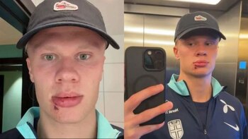 El llamativo accidente que sufrió