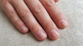 Primer plano de una mano sobre tela, con dedos extendidos y uñas que presentan varias manchas blancas pequeñas.
