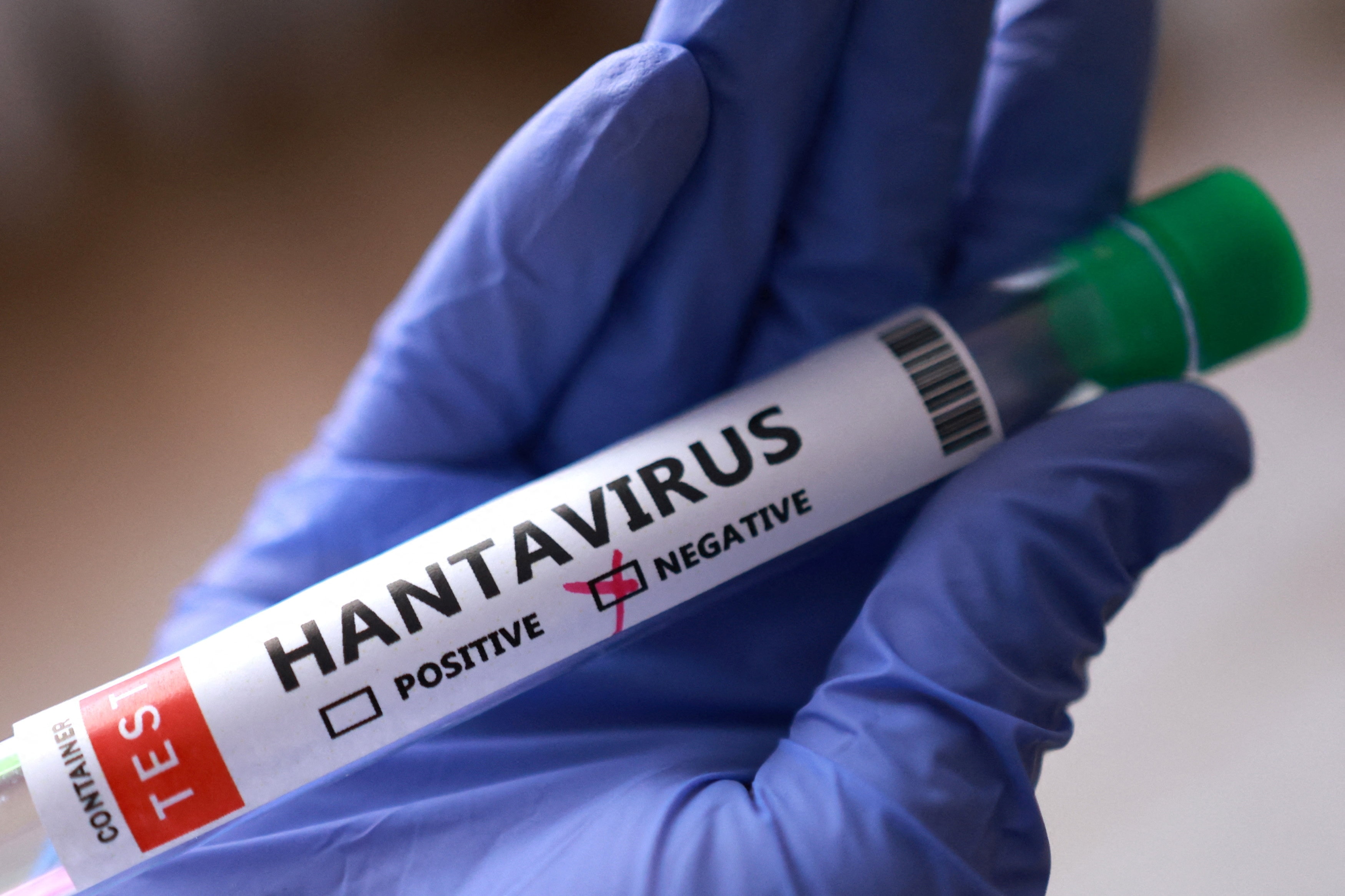 Brote de Hantavirus en Crucero Desata Alerta Sanitaria Internacional — image 2