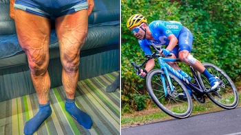 Impactante foto de las piernas