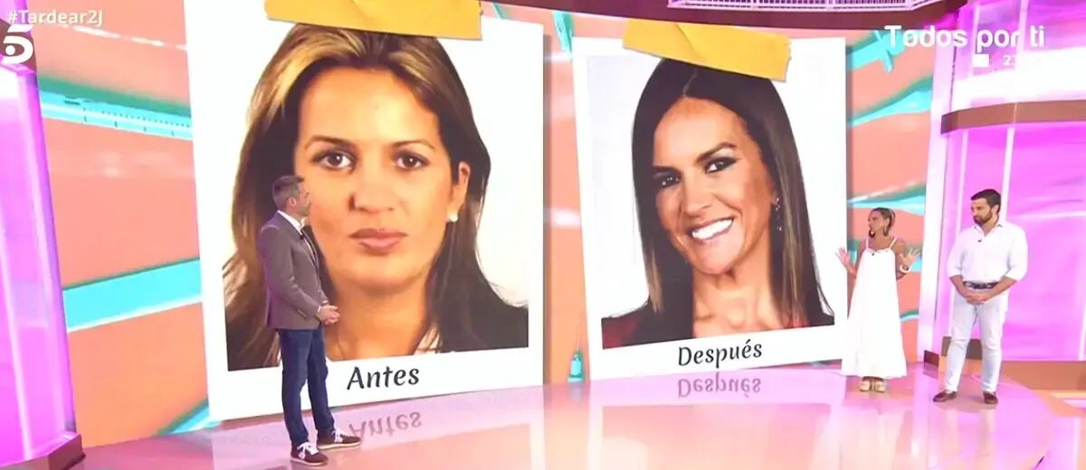 Las operaciones estéticas de Marta López. (Telecinco)