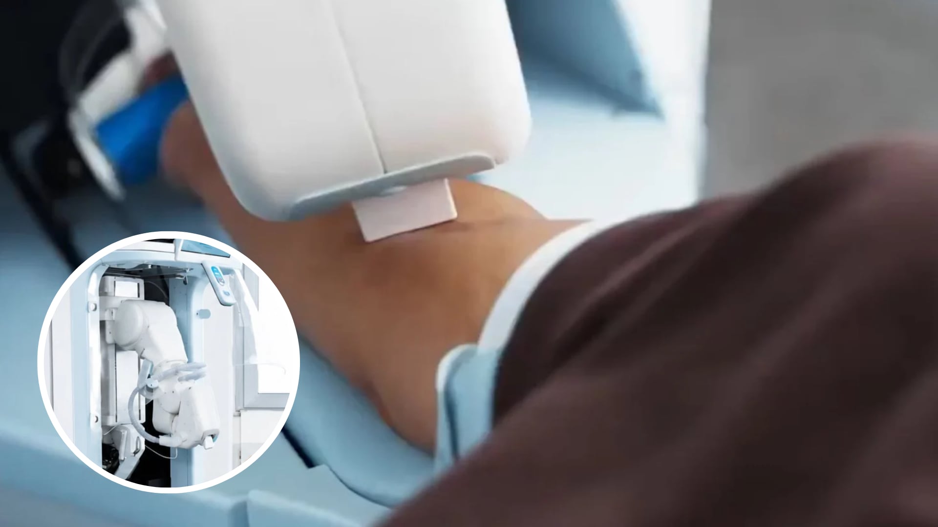 El punto de partida del sistema es la localización precisa del vaso sanguíneo.
(Composición Infobae: TechSpot)