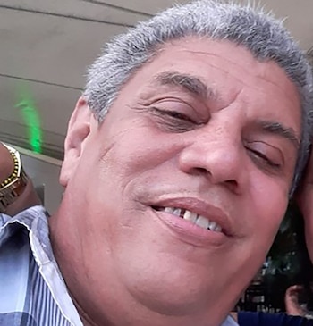 Primer plano de un hombre de mediana edad con cabello gris, sonriendo con los ojos entrecerrados y un diente frontal superior faltante