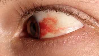 Los alimentos eficaces contra la