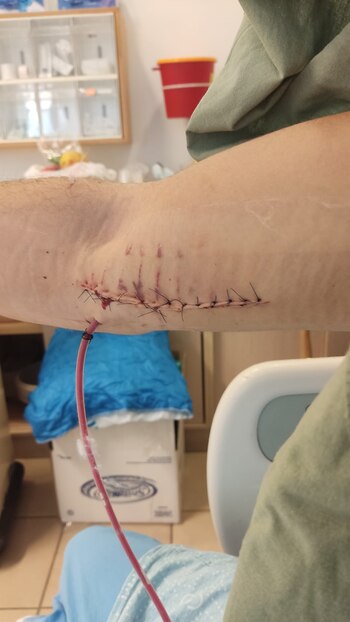 En el hospital de Tel