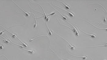 El análisis de muestras de