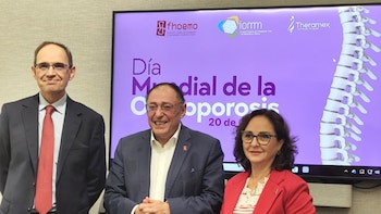 FHOEMO y SEIOMM piden que los más de dos millones de mujeres de 45 a 50 años reciban evaluación ósea en perimenopausia