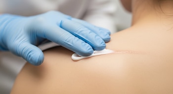 Estos hallazgos abren la puerta