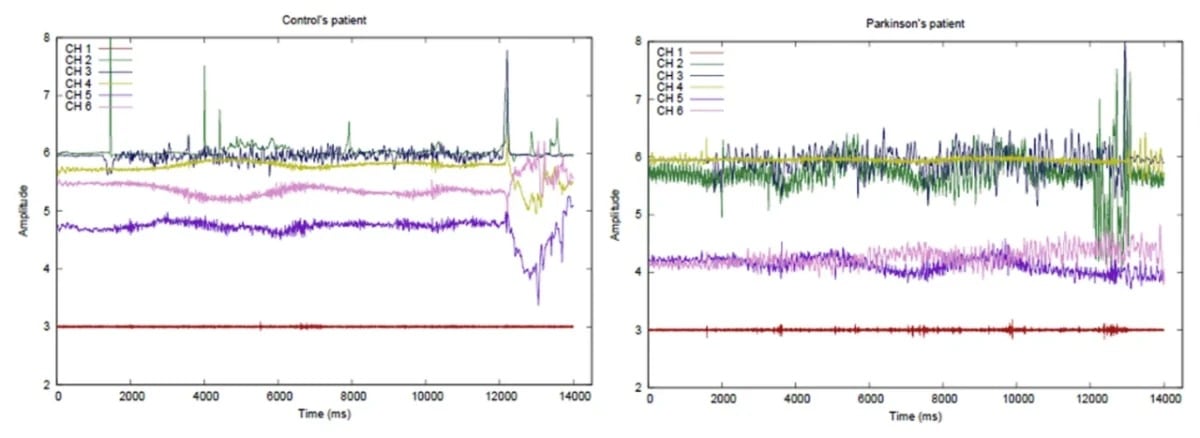 Se emplean modelos de redes neuronales profundas para procesar la información (Ayus et al., Discov. Comput ., 2026)