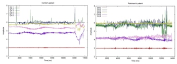 Se emplean modelos de redes neuronales profundas para procesar la información (Ayus et al., Discov. Comput ., 2026)