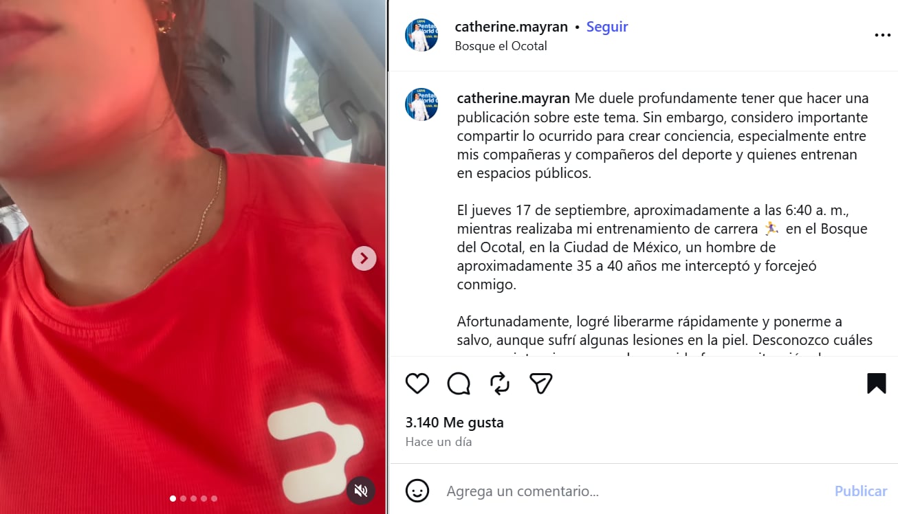 La atleta Catherine Mayran muestra marcas en su cuello tras denunciar un intento de agresión mientras entrenaba en el Bosque del Ocotal, en la Ciudad de México. (Instagram: Catherine Mayran)