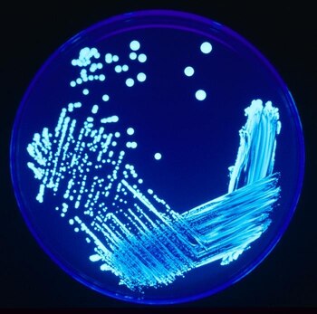 Bacterias como Legionella pueden estar